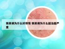 银屑病为什么好得慢 银屑病为什么越治越严重