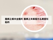 胳膊上癣大全图片 胳膊上长癣是什么原因引起的