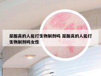 尿酸高的人能打生物制剂吗 尿酸高的人能打生物制剂吗女性