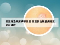 三豆粥治银屑病哪三豆 三豆粥治银屑病哪三豆可以吃