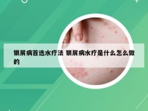 银屑病首选水疗法 银屑病水疗是什么怎么做的