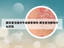 藏生堂泡澡对牛皮癣管用吗 臧生堂泡脚有什么好处