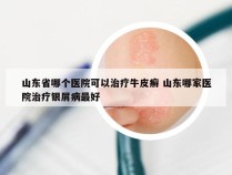 山东省哪个医院可以治疗牛皮癣 山东哪家医院治疗银屑病最好