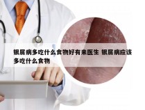 银屑病多吃什么食物好有来医生 银屑病应该多吃什么食物