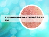 掌趾脓疱疹需要注意什么 掌趾脓疱疹吃什么药好