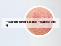 一抹灵银屑病的抹多长时间 一抹灵能治皮癣吗