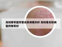 南阳那家医院看皮肤病看的好 南阳看皮肤病医院哪家好