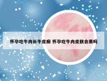 怀孕吃牛肉长牛皮癣 怀孕吃牛肉皮肤会黑吗