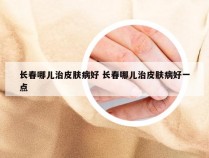 长春哪儿治皮肤病好 长春哪儿治皮肤病好一点