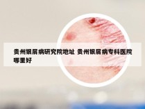 贵州银屑病研究院地址 贵州银屑病专科医院哪里好