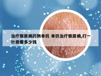 治疗银屑病药物单抗 单抗治疗银屑病,打一针需要多少钱