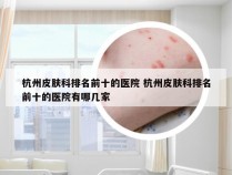 杭州皮肤科排名前十的医院 杭州皮肤科排名前十的医院有哪几家