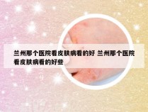兰州那个医院看皮肤病看的好 兰州那个医院看皮肤病看的好些