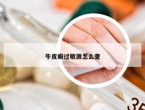 牛皮癣过敏源怎么查