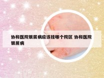 协和医院银屑病应该挂哪个院区 协和医院 银屑病