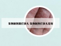 生物制剂需打多久 生物制剂打多久见效