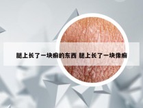 腿上长了一块癣的东西 腿上长了一块像癣