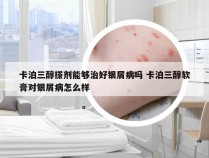 卡泊三醇搽剂能够治好银屑病吗 卡泊三醇软膏对银屑病怎么样