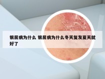 银屑病为什么 银屑病为什么冬天复发夏天就好了