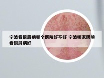 宁波看银屑病哪个医院好不好 宁波哪家医院看银屑病好