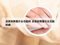 点状白斑是什么引起的 点状白斑是什么引起的病