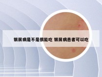 银屑病是不是很能吃 银屑病患者可以吃
