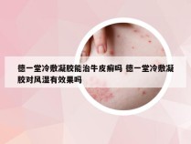 德一堂冷敷凝胶能治牛皮癣吗 德一堂冷敷凝胶对风湿有效果吗