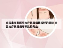 南昌市哪家医院治疗银屑病比较好的医院 南昌治疗银屑病哪家比较专业