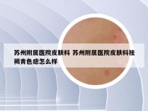 苏州附属医院皮肤科 苏州附属医院皮肤科祛褐青色痣怎么样