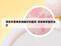 渭南市看银屑病最好的医院 渭南哪家医院治疗