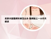皮肤大腿胳膊长癣怎么办 胳膊腿上一小片片癣状