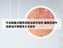 牛皮癣偏方醋熬花椒治癣可信吗 醋跟花椒牛皮廨治疗需要多久才能好