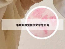 牛皮癣康复案例文章怎么写