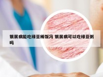 银屑病能吃绿豆稀饭冯 银屑病可以吃绿豆粥吗