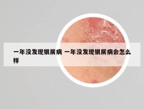 一年没发现银屑病 一年没发现银屑病会怎么样