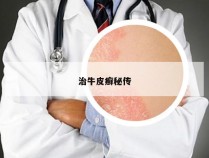 治牛皮癣秘传