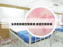 女孩患脓疱型银屑病 脓疱性银屑病