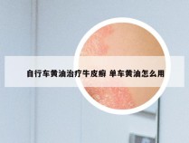 自行车黄油治疗牛皮癣 单车黄油怎么用