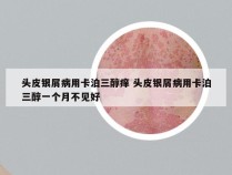 头皮银屑病用卡泊三醇痒 头皮银屑病用卡泊三醇一个月不见好