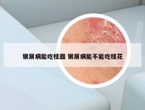 银屑病能吃桂圆 银屑病能不能吃桂花