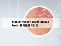 stat3信号通路与银屑病 pi3kaktmtor信号通路与炎症