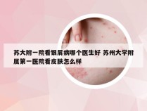 苏大附一院看银屑病哪个医生好 苏州大学附属第一医院看皮肤怎么样