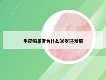 牛皮癣患者为什么30岁还发病