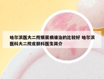 哈尔滨医大二院银屑病谁治的比较好 哈尔滨医科大二院皮肤科医生简介