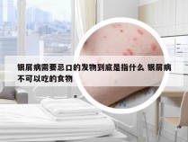 银屑病需要忌口的发物到底是指什么 银屑病不可以吃的食物