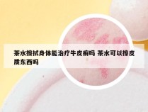 茶水擦拭身体能治疗牛皮癣吗 茶水可以擦皮质东西吗