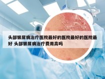 头部银屑病治疗医院最好的医院最好的医院最好 头部银屑病治疗费用高吗