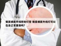 银屑病紫外线照射灯管 银屑病紫外线灯可以在自己家里做吗?