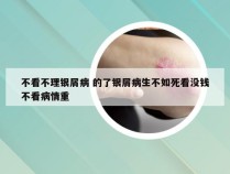 不看不理银屑病 的了银屑病生不如死看没钱不看病情重