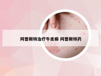阿普斯特治疗牛皮癣 阿普斯特药